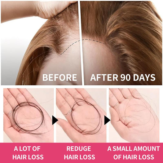 45-Day Supply | Hiplus Hair Growth Accelerator – Beauty Vitamin | for Thicker Hair, Nourishes Thinning & Loss, Collagen, Biotin | Clinically Proven, Dermatologist Recommended